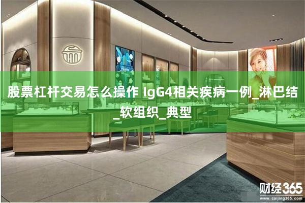 股票杠杆交易怎么操作 IgG4相关疾病一例_淋巴结_软组织_典型